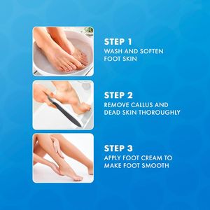 Kit de pedicura profesional mejorado 2022 blanco 3 en 1 10,5 \ "X 2 \" Lima de pie de 2 lados raspador adicional 304 pies removedores de callos - Product Image 4