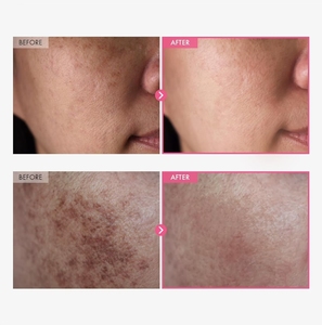 Crema Coreana para el Cuidado de la Piel, Manchas Oscuras, Pecas, Imperfecciones, Pigmentación, TOSOWOONG Arbutina 7% + Ácido Tranexámico 4%, Sin Perfume - Product Image 5