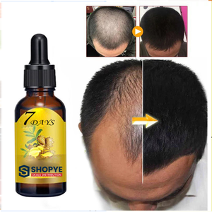 Acondicionador Capilar Herbal de Jengibre Caliente, Humectante Líquido para un Crecimiento del Cabello Suave, Esencia - Product Image 1