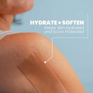 Usine vendant le meilleur ruban de <span class=keywords><strong>silicone</strong></span> feuilles de gel médical traitement de retrait de <span class=keywords><strong>cicatrice</strong></span> de plâtre de <span class=keywords><strong>pansement</strong></span> réutilisable - Product Image 2