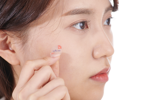 แผ่นปิดสิวไฮโดรคอลลอยด์ 12 มม. |   ผลิตภัณฑ์รักษารอยดำและปกปิดรอยแผลแบบเนียนเรียบ |   เกาหลี OEM - Product Image 2