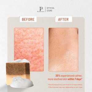 Savon en barre Puresia, savon médicinal naturel 90g pour soulager l'eczéma et le psoriasis, mousse douce, adapté à tous les types de peau, fabriqué en Indonésie - Product Image 5