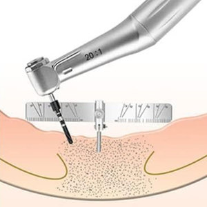 Orthopedic Surgical Instruments Measuring Ruler Locating Guide Surgical Positioning Locator Angle <b>Gauge</b> Autoclavable Stainless - Product Image 5
