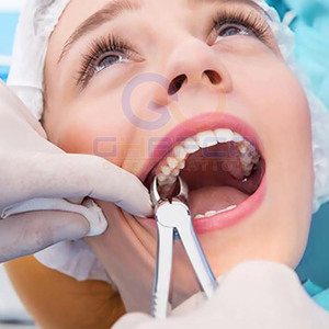 Pinzas de Extracción Dental de Acero Inoxidable de Alta Calidad para Venta en Línea - Product Image 3