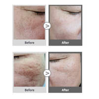 GTM MELACELL+ Ampoule Liquide Éclaircissante Visage Acide Tranexamique Glutathion PDRN Niacinamide Soin Anti-Taches Teint Éclatant 35ml
