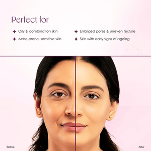 Crema Antiedad Mridutvam para Piel Grasa, Control de Grasa, Reducción de Poros y Luminosidad Juvenil - Product Image 3