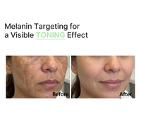 Kore cilt bakımı PDRN Traneksamik Asit Serumu Altın Peptit koyu leke hiperpigmentasyon AHA Günlük Peeling Derin Nemlendirme