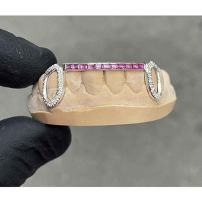 Grillz de luxe Hip Hop en diamant avec couvre-dents sur mesure, bijoux de mode haut de gamme pour hommes et femmes - Product Image 2