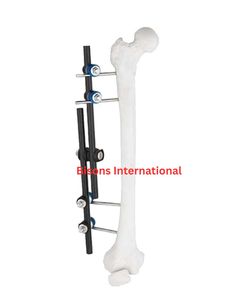 Kit chirurgical orthopédique BISONS de haute qualité pour la fixation des fractures du tibia et du fémur, avec instruments de fixation externe des membres inférieurs - Product Image 3