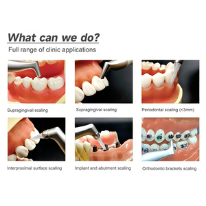 Dispositivo de Limpieza Dental por Arenado Supragingival de Alta Eficiencia al por Mayor AIRJET, Pieza de Mano Dental para Pulido por Aire CE - Product Image 3