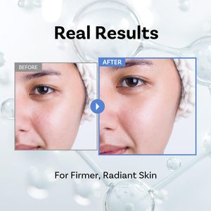 [APOTHE] Emulsión de Esencia de Péptido 11 Botulinum 150ml Antienvejecimiento, Antiarrugas, Reafirmante para Mujeres, Todo Tipo de Piel, en Botella - Product Image 2