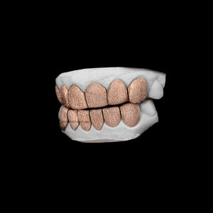 Grillz Hip Hop sur mesure en argent sterling 925 plaqué or, serti de moissanite, pour dents - Product Image 2