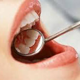 Customized <b>Double</b>-<b>Sided</b> Stainless Steel Dental <b>Mirrors</b> Steel Mouth Front Surface Oral Hygiene Multi-Purpose Mouth <b>Mirror</b> - Product Image 4