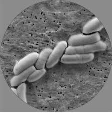 Bifidobacterium Lactis en Polvo Blanco, 100 Mil Millones de UFC/gramo, para la Salud Intestinal Infantil, Alergias Gastrointestinales e Inflamaciones Pediátricas - Product Image 2