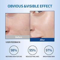Essence faciale en gros Pdrn Sérum à l'ADN de saumon Soins de spa à domicile Anti-âge Réparation des rides Niacinamide Blanchiment Ampoule pour le visage