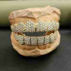 Juego de Grillz de Diamantes Personalizados DOPE JEWELLS, Chapado en Oro de Ley 925, Engaste Pavé, Joyería Hip Hop para Hombre, 10.78 CT - Product Image 1