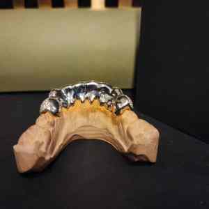 Ensemble de grillz en diamant avec pavé complet en argent sterling 925, bijoux de bouche pour rappeur hip-hop - Product Image 4