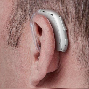 เครื่องช่วยฟัง Oticon Xceed 2 SP รุ่นใหม่ล่าสุด ทรง BTE กำลังขยายเสียงสูง พร้อมบลูทูธ รองรับอาการหูอื้อ - Product Image 4
