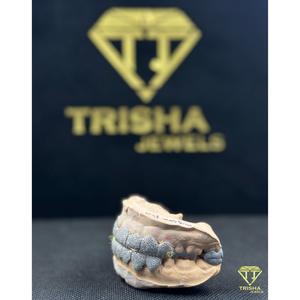 Grillz personnalisés en moissanite VVS taille diamant pour hommes, entièrement sertis, en argent sterling 925, style Hip Hop, par Trisha Jewels - Product Image 2