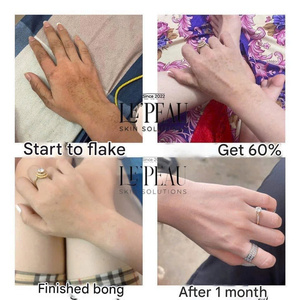 LE'PEAU Peel Body Retinol 150ml VN Loción corporal exfoliante 7 días Iluminador y desvanecimiento de manchas oscuras para belleza y cuidado personal - Product Image 5