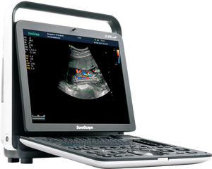 SonoScape S8 ExpV - Sistema de Ultrasonido Doppler Color Digital Portátil y Duradero, Escáner Veterinario Sonoscape para Clínica y <span class=keywords><strong>Hospital</strong></span> - Product Image 2