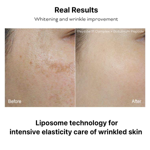Suero de Péptidos de Recuperación Múltiple APOTHE con Botulina 30mL, Suero Facial Antienvejecimiento, Antiarrugas y Blanqueador, Hecho en Corea - Product Image 3