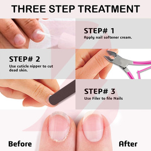 ที่ตัดหนังกำพร้าสีชมพูสดใส ด้ามจับสีชมพูสดใส ทำจากสแตนเลสสตีล พร้อมใบมีดคมสำหรับตัดหนังกำพร้า อุปกรณ์ทำเล็บ - Product Image 3