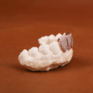 Grillz Diamant Scintillant Personnalisé – Capuchons Dentaires Hip Hop Tendance avec Artisanat de Qualité Supérieure - Product Image 2