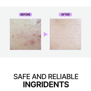 AHA Niacinamide Serum Korean Facial Serum Skin Refining Ampoule pore care Brightening Care for Smooth Healthy Looking Skin - Product Image 4