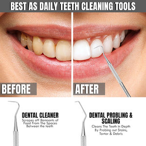 Professional Dental Tartar Scraper Double Ended Stainless Steel Dental Probe & Scaler for Plaque Tartar Stain Removal - Product Image 6