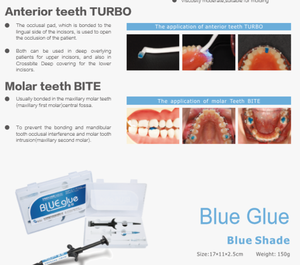 <span class=keywords><strong>Colle</strong></span> bleue de qualité supérieure XIHUBIOM, ouverture Turbo Bite, durcissement à la lumière, <span class=keywords><strong>ciment</strong></span> pour bande - Product Image 4