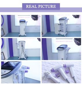 Appareil de rajeunissement et de resserrement cutané à traitement fractionné pour l'élimination des cicatrices verticales, avec marteau froid puissant, pour usage en centre de beauté - Product Image 6