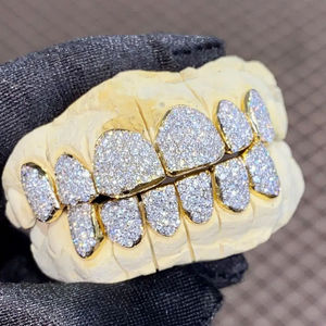 Grillz de luxe en or et diamants – Bijoux dentaires entièrement incrustés - Product Image 1