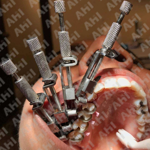 คู่มือการออกแบบระดับมืออาชีพ ตัวยึดเมทริกซ์สแตนเลสสตีล จับถนัดมือ ทนทาน ใช้ซ้ำได้ ได้รับการรับรองมาตรฐาน CE ระดับที่ 3 เครื่องมือทันตกรรม - Product Image 5