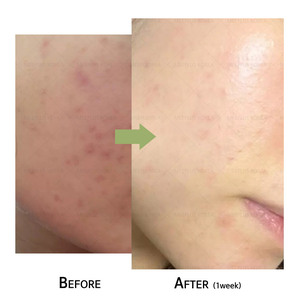 เซรั่มใบบัวบกเนื้อบางเบา บำรุงผิวประจำวัน สำหรับผิวแพ้ง่าย - Product Image 3