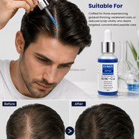 EKBER Maßgeschneidertes Blaues Kupferpeptid AHK-Cu Serum Haarwuchsserum AHK-Cu Haarwuchsöl Anti-Haarausfall-Behandlung für Frauen & Männer