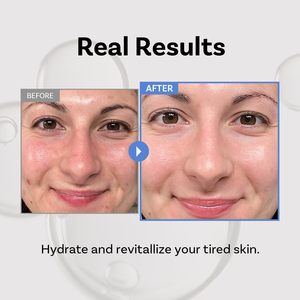 [APOTHE] Tónico Esencial con Péptido 11 Botulinum 250ml, Hidratación Profunda, Fortalecimiento de la Barrera Cutánea, Humectante con Edelweiss, Antienvejecimiento - Product Image 2