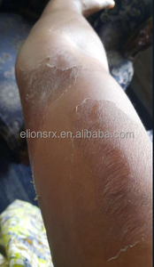 Solution de peeling éclaircissante professionnelle liquide à 50 % pour le visage et le corps, 100 ml, sérum anti-imperfections, marque privée, OEM - Product Image 6