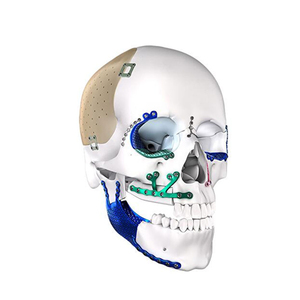 Kit d'instruments chirurgicaux pour la réconstruction maxillo-faciale, outil de pliage de plaques, réutilisable, acier inoxydable de qualité allemande, manuel, CE - Product Image 4