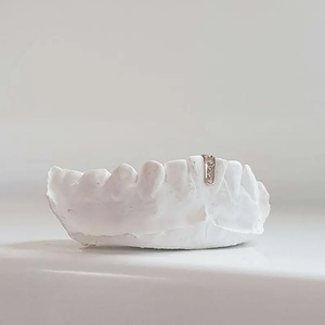 Grillz dentaire blanc avec diamants taille baguette sertis en canal, style hip-hop unisexe, bijoux corporels pour usage quotidien - Product Image 1