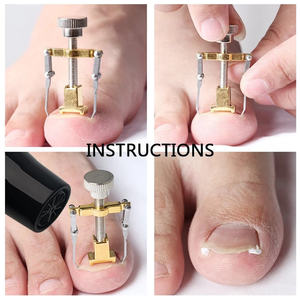 Correcteur d'ongles incarnés, instrument chirurgical de pédicure, fixateur d'ongles, soin des ongles des pieds, orthopédique, en acier inoxydable, métal et plastique - Product Image 6