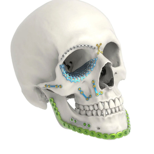 ชุดเครื่องมือผ่าตัดศัลยกรรมใบหน้าและขากรรไกรคุณภาพสูง ผลิตจากไทเทเนียมและสแตนเลสสตีล โดย Mahfooz Instruments - Product Image 5