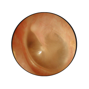 Otoscopio de Fibra Óptica con Cuerpo Metálico Vitra Diagnostics VDA1016 para Uso Clínico y Hospitalario, Certificado ISO13485 CE - Product Image 3