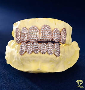 Grillz personnalisés haut de gamme en argent 925 avec moissanite VVS, ajustement sur mesure, entièrement sertis de pierres, kit de moulage gratuit et livraison rapide - Product Image 3