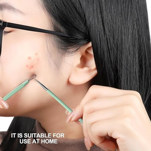 เครื่องดูดสิวเสี้ยนสแตนเลสคุณภาพสูงระดับมืออาชีพ สำหรับผิวสะอาด - Product Image 4