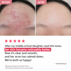 Tónico Facial Dr. Deep Tea Tree 200ml PHA, Exfoliante Suave, Hidratante, Calmante, Control de Sebo, Cuidado del Acné, Cosmética Coreana - Product Image 2