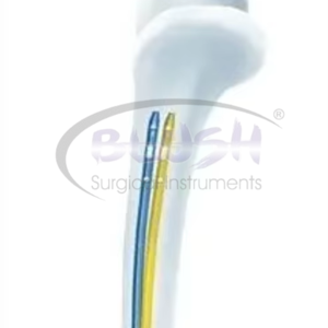 2 Pcs Supply Titanium Manual Orthopedic Implant Posterior Orthopedic PFNAF emoral Intramedullary Nail By <b>Blush</b> Surgical - Product Image 6