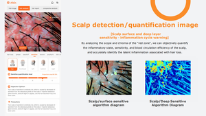 Analizador de Piel Aisia de 8 Megapíxeles, Máquina Portátil de Análisis de Piel, Analizador de Cuero Cabelludo con IA, Máquina Analizadora de Piel y Cabello - Product Image 5