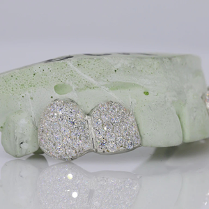 Grillz dentaire Hip Hop personnalisé en argent 925, serti de diamants Moissanite, bijoux dentaires en argent, meilleur prix - Product Image 3