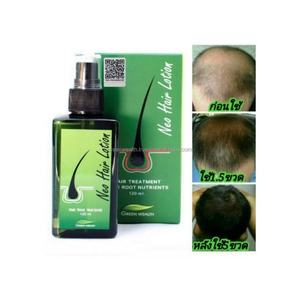 Para la riqueza verde 100% Extracto de hierbas naturales tratamiento orgánico para el cabello reparación refrescante Spray uso diario con precio de fábrica fresco - Product Image 5